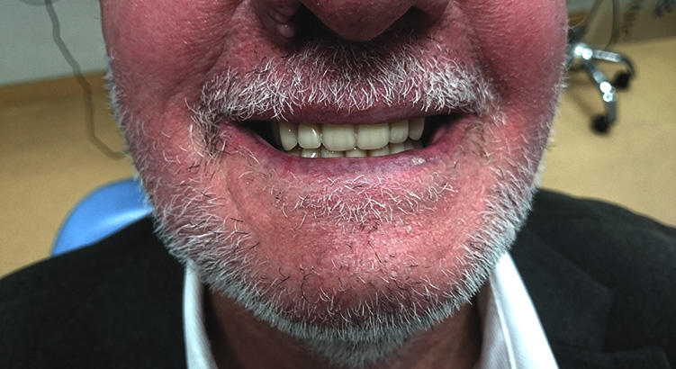 Dentist & Denture Services Epping, Sydney | Implicit Dental